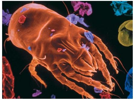 A scanning electron micrograph of a dust mite, a source of allergens that cause allergic reactions. (Reproduced by permission of Phototake.)