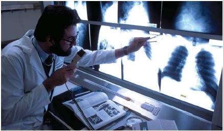 A physician recording his diagnosis on audiotape while viewing a patient's chest X ray. (Reproduced by permission of The Stock Market.)