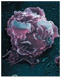 A colored scanning electron micrograph of a white blood cell. (Reproduced by permission of Photo Researchers, Inc.)