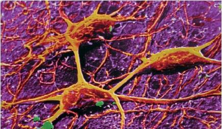 A scanning electron micrograph of three neurons in the human brain. (Reproduced by permission of Photo Researchers, Inc.)