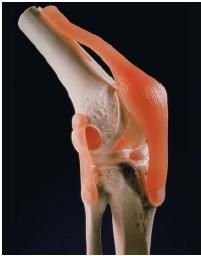 An artificial knee joint made out of plastic. (Reproduced by permission of Photo Researchers, Inc.)
